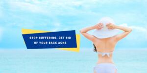 Home Remedies to Get Rid of Back Acne (Bacne)