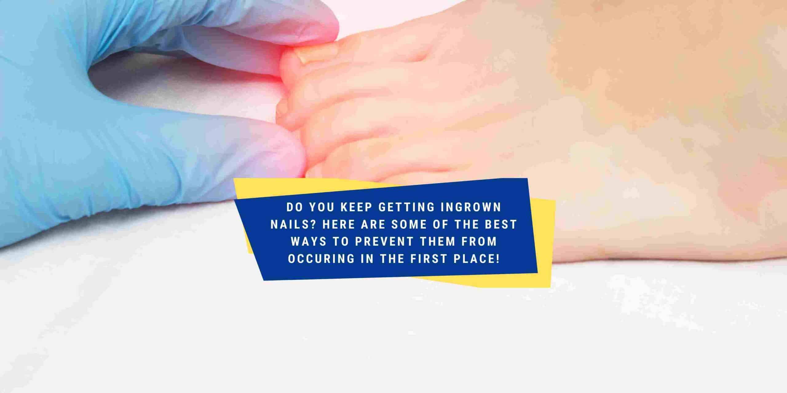 How to Prevent Ingrown Nails?