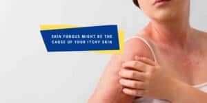 How To Prevent Skin Fungus: Tips For Keeping Your Skin Healthy