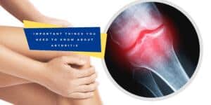 Things About Arthritis That Are Important To Know