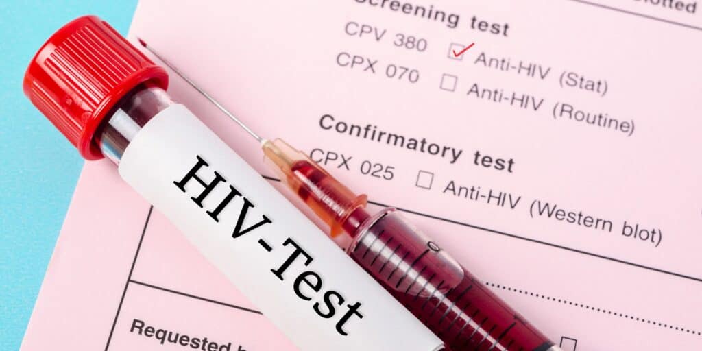 HIV test