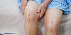 Knee pain treatment Singapore