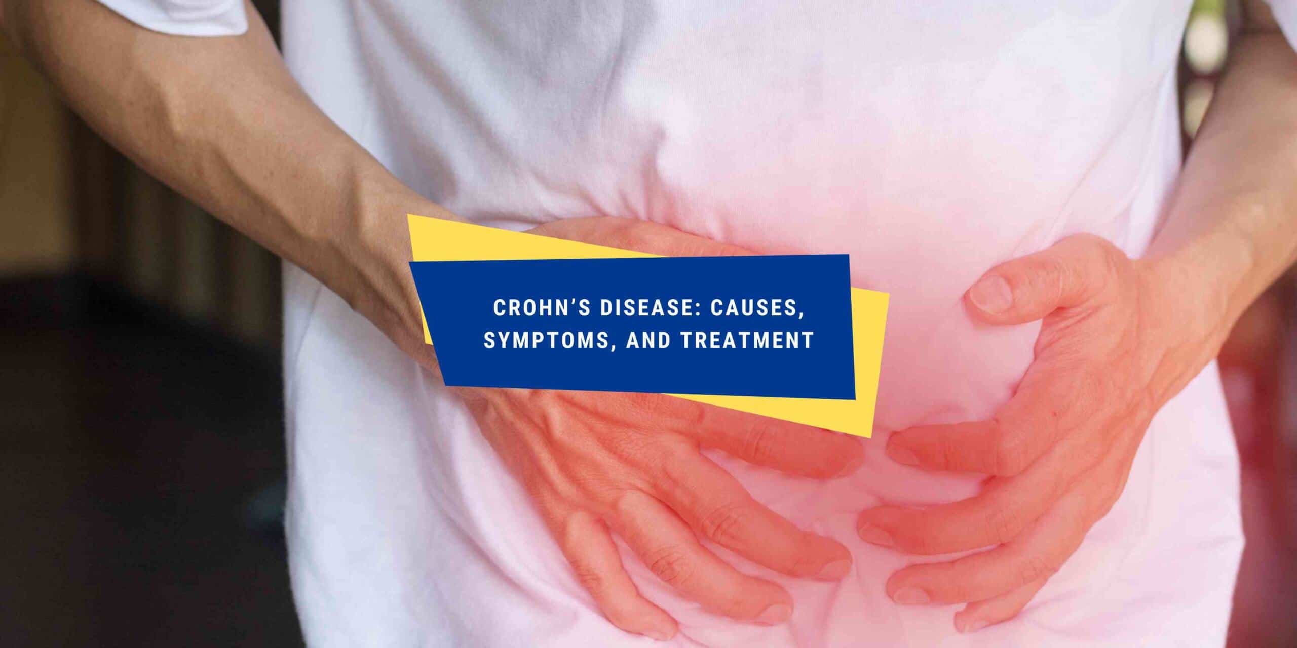 Crohn's Disease: Causes, Symptoms, and Treatment