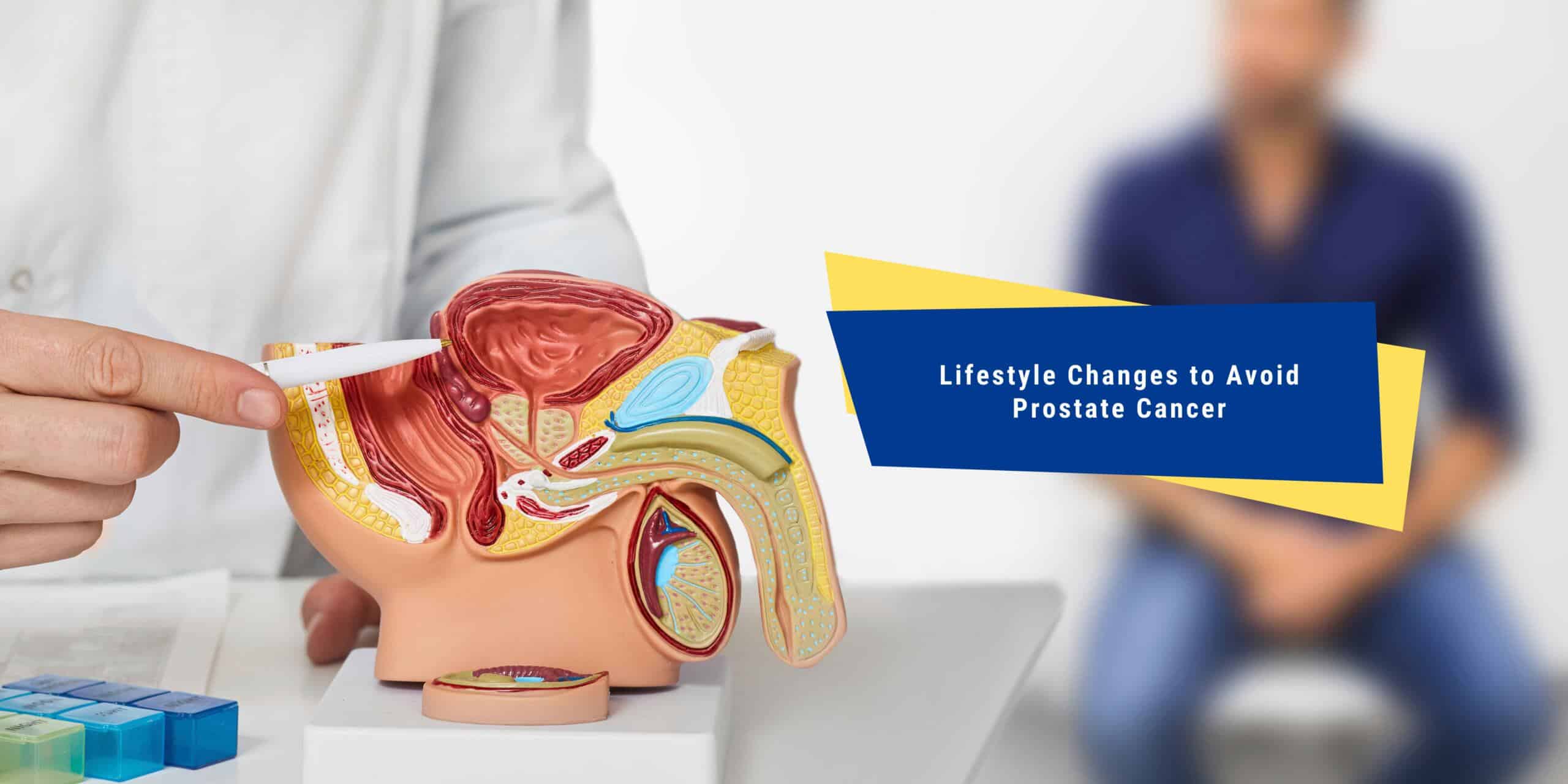 Lifestyle Changes to Avoid Prostate Cancer