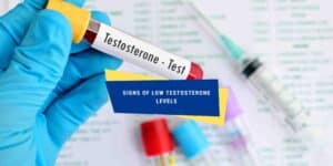 testosterone